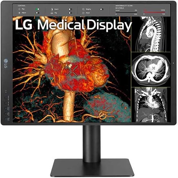 LG Electronics 21HQ513D-S MED 21 inch IPS 3MP Diagnostic Monitor 2048 X 1536 FDA